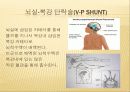 (성인-수술실컨퍼) 뇌실 - 복강간 단락수술(사진 많음, 동영상 있음) 11페이지